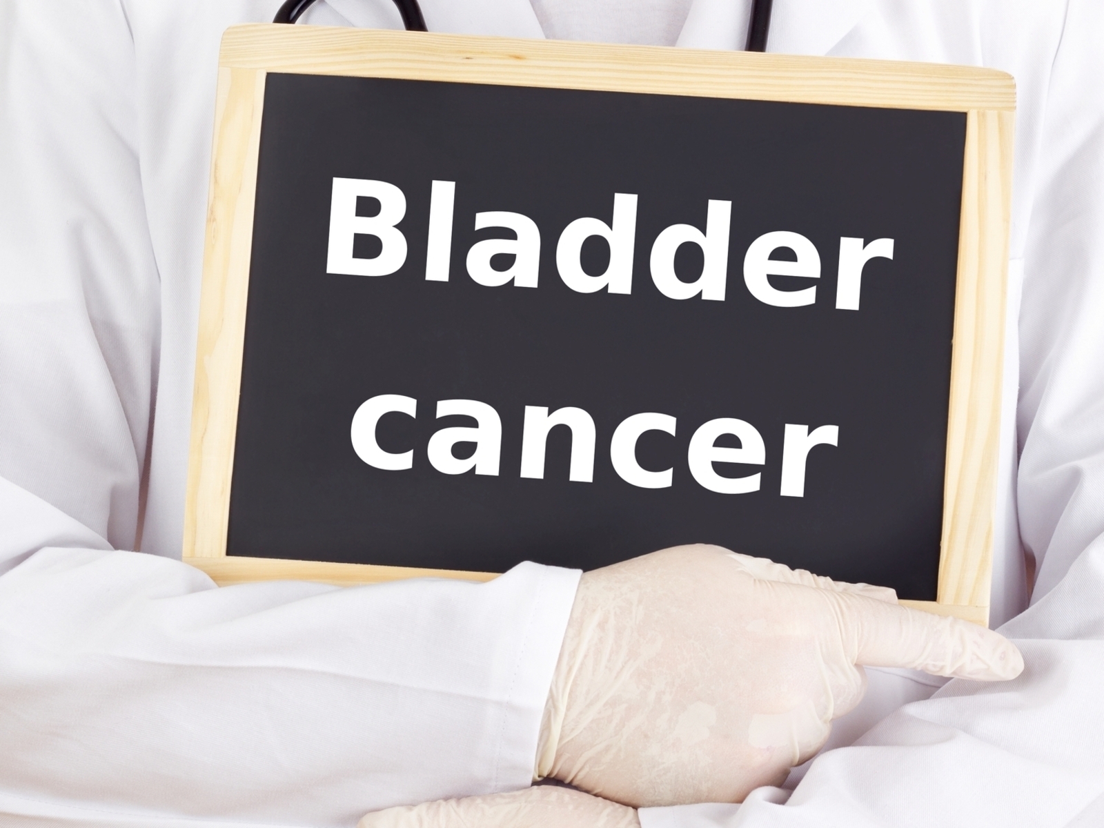5 Early Warning Signs of Bladder Cancer