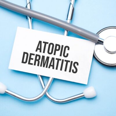 5 Soaps That Trigger Atopic Dermatitis