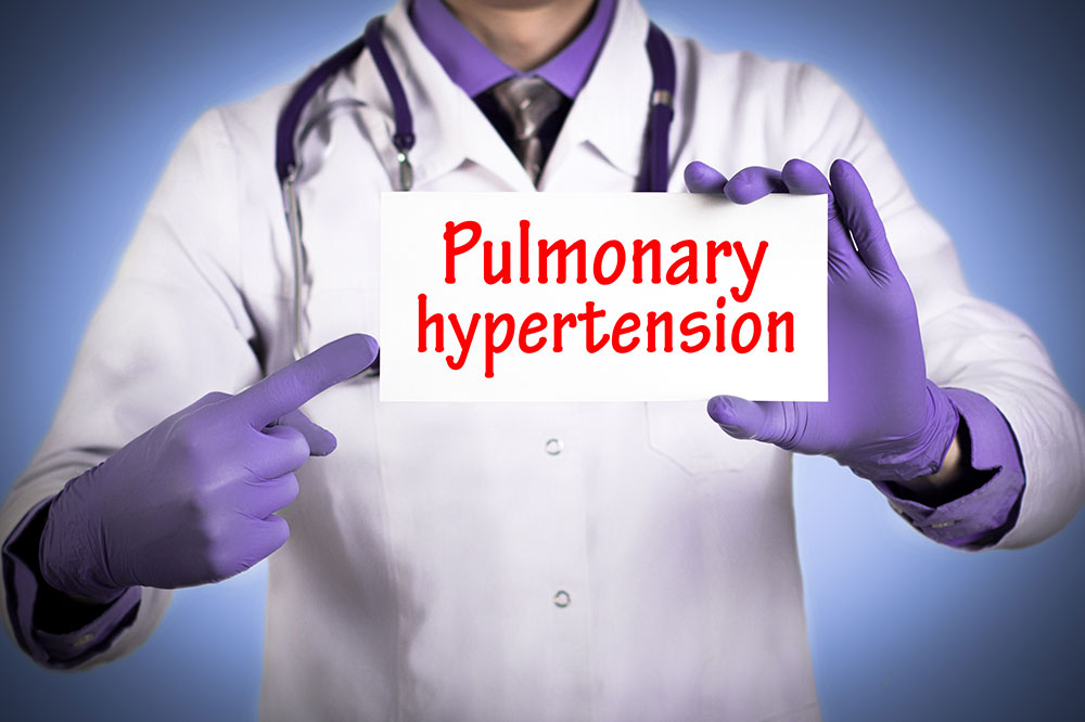 A Guide on Differences Between PAH and Pulmonary Hypertension