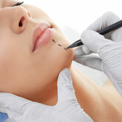 Plastic Surgery for Scar Revision