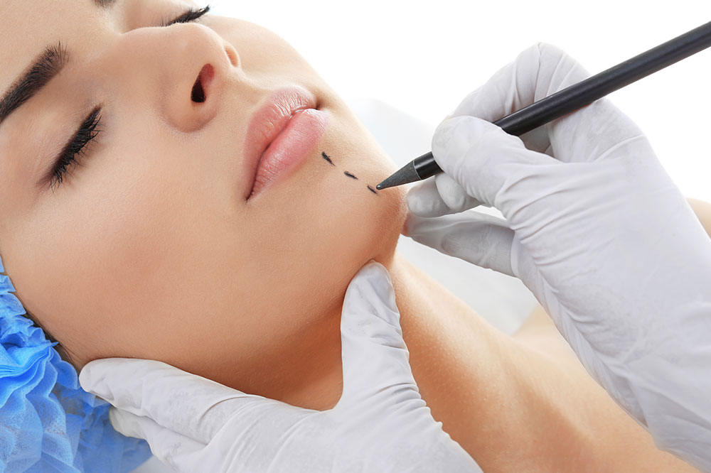 Plastic Surgery for Scar Revision