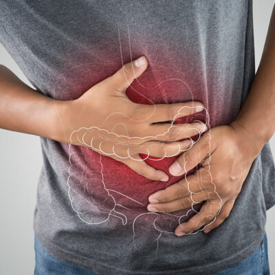 6 Colon Cancer Risk Factors to Be Aware Of