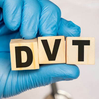 6 Major Signs of DVT and Other Symptoms